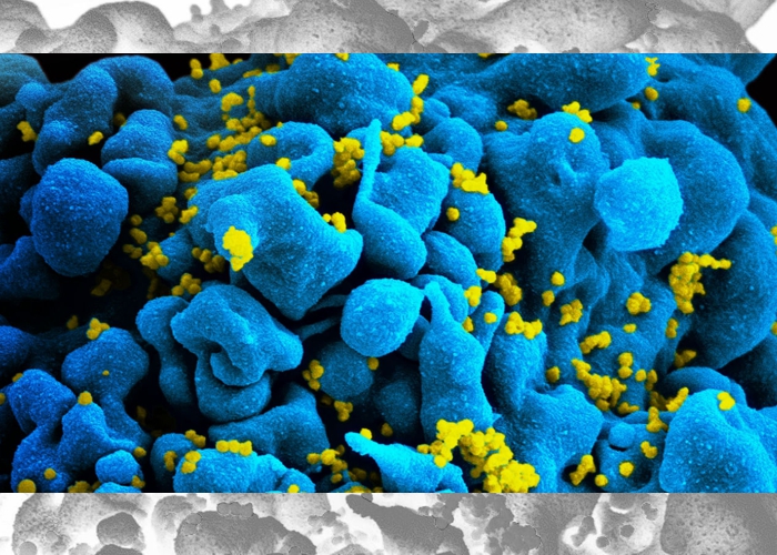 Cientistas descobrem como HIV escapa do tratamento