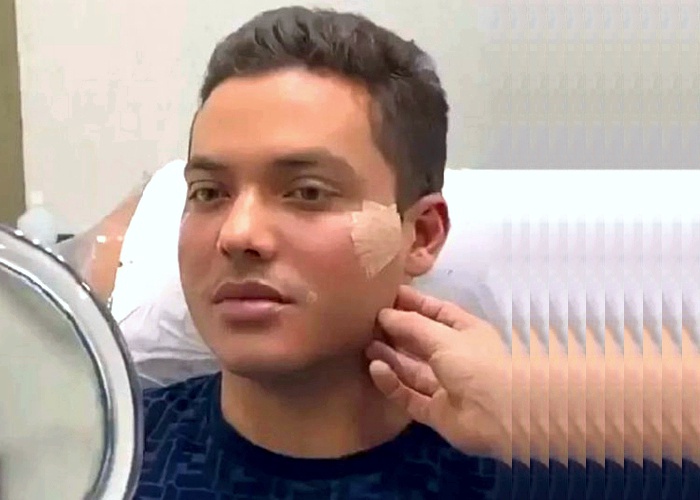 Após harmonização facial, Wesley Safadão foi comparado ao Ken Humano