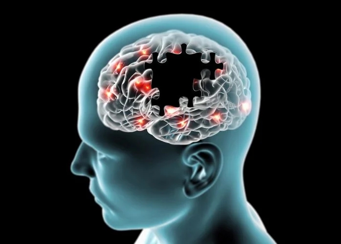 Parkinson: nova pesquisa aponta que doença pode estar associada a bactéria aquática comum