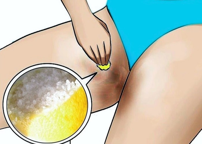 Virilha escura: As causas e os melhores tratamentos para a mancha de pele