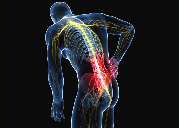 5 coisas que você deveria saber sobre dores nas costas