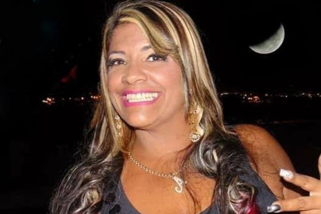 Cantora morre após tirar gordura das costas pra colocar nos glúteos