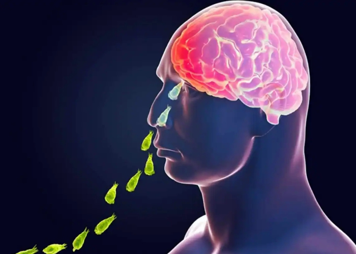 Homem morre após contrair ameba ‘comedora de cérebro’