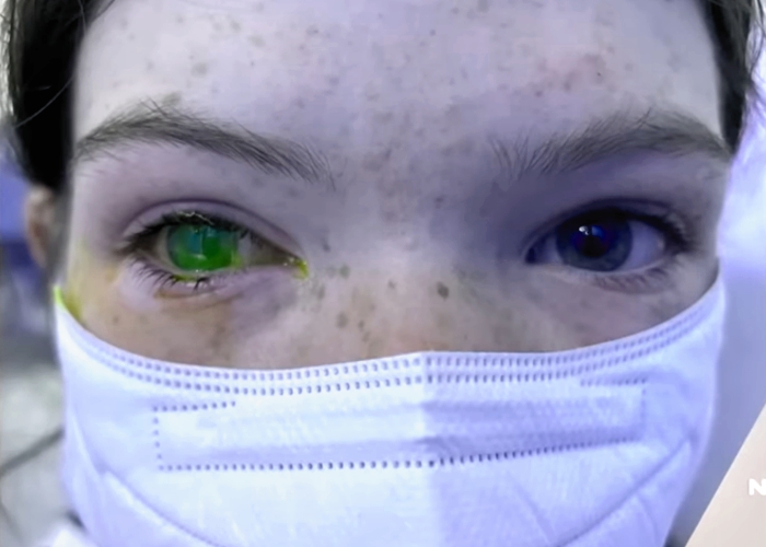 Doença do ‘olho de Natal’ provoca dor comparável à do parto